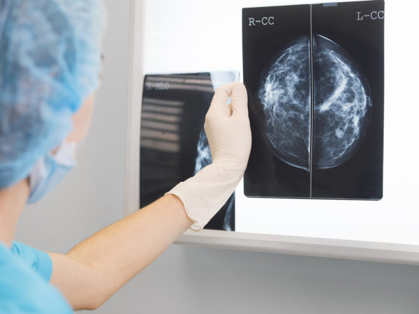 Better Breast Cancer Surgery? | Cancer | Andrew Weil, M.D.