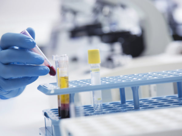 Laboratory assistant analyzing a blood sample