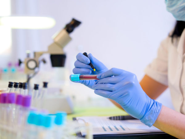 Woman working in a laboratory. He writes with a felt pen. Selective focus