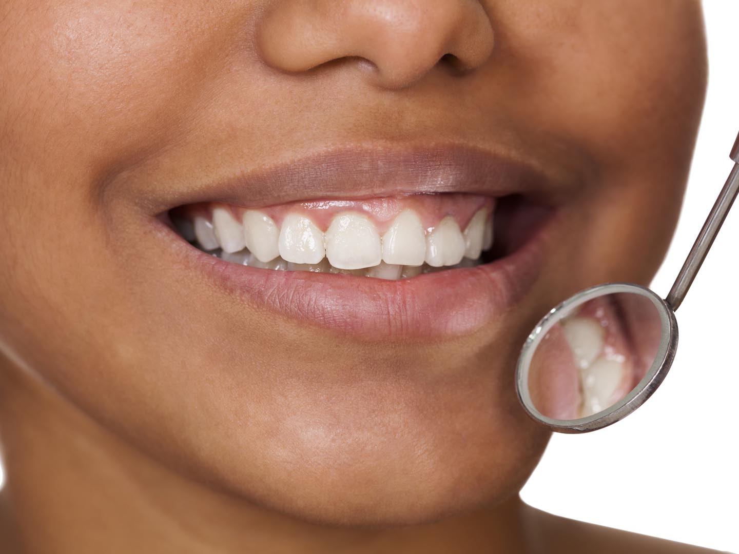 Healthy Woman Teeth. Isolated On White Background