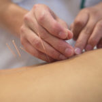 acupuncture for constipation