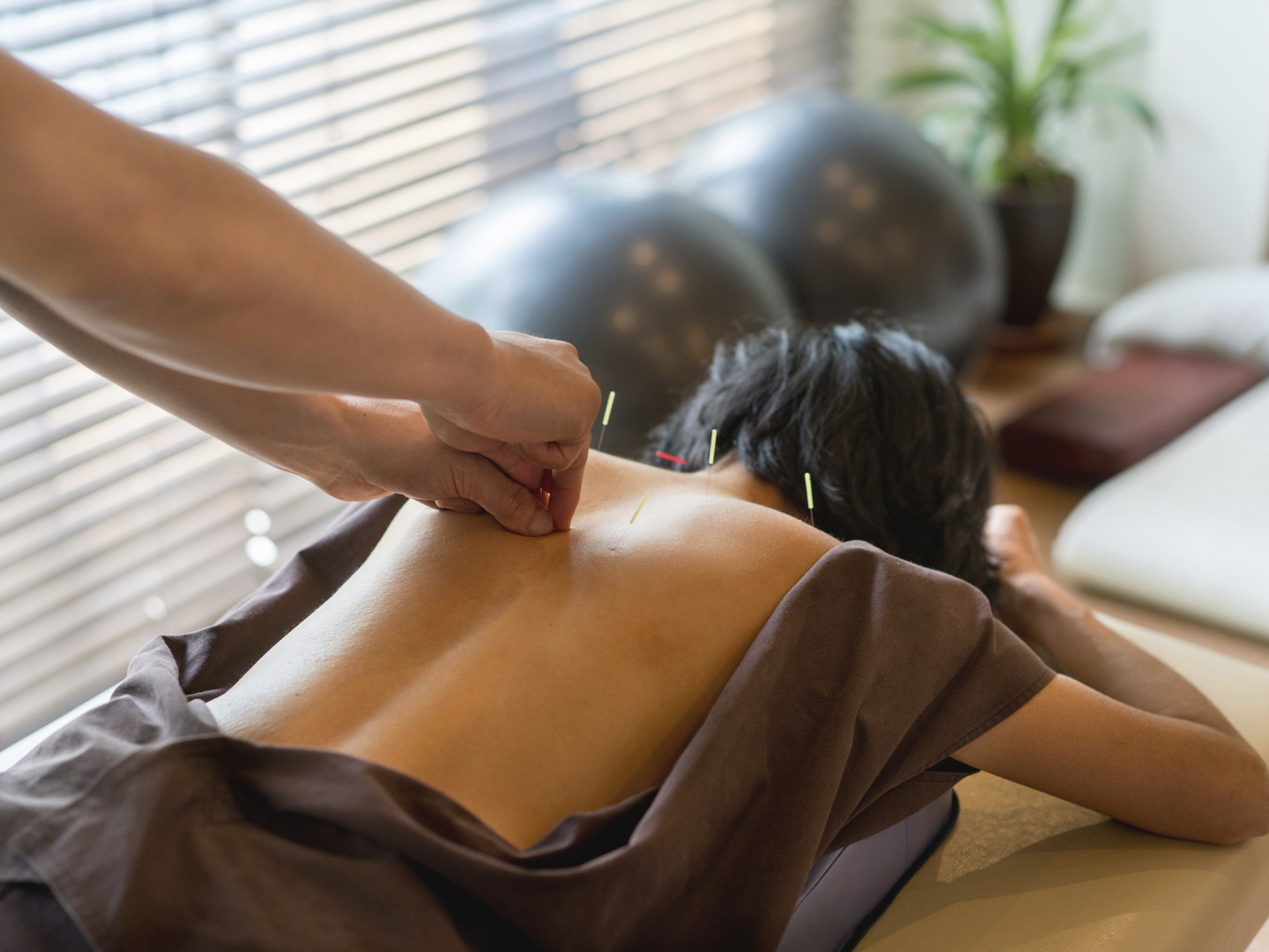 Woman at the acupuncturist and doctor placing needles on her back - alternative medicine concepts